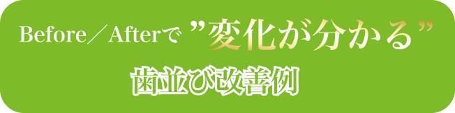 Before/Afterで”変化がわかる”歯並び改善例