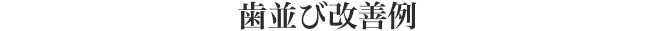 歯並び改善例